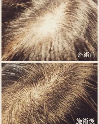 eyelash目髪 瓢箪山店の眉毛・アイブロウイメージ