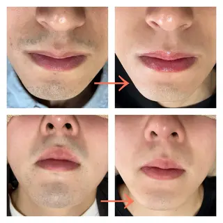 サロンドチェリー 《我妻》のエステ・リラクイメージ