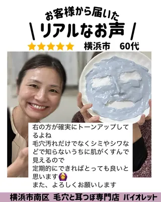 毛穴と耳つぼ専門店 バイオレット　りののその他イメージ