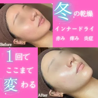 痩身&美肌サロン 堀米✨のその他イメージ