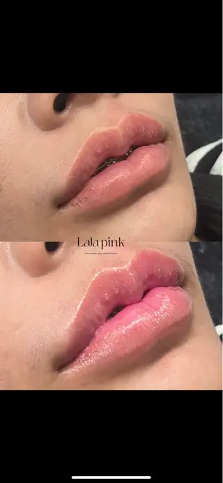 KIRAN 山﨑のエステ・リラクイメージ