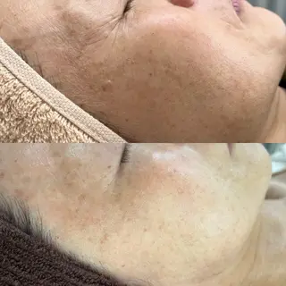 BeautySalo nCielChibaのエステ・リラクイメージ