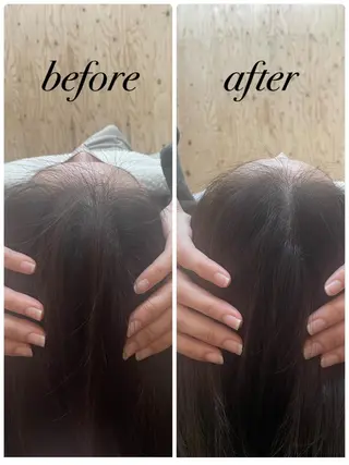 個室ドライヘッドスパ 🍃moriのエステ・リラクイメージ