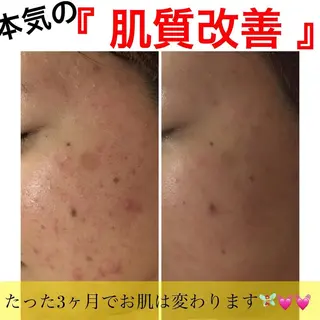 ミディアム カラー パーマ ヘアアレンジ メンズ キッズ ネイル マツエク・マツパ ニキビ・肌質改善専門 ♡人生が変わるサロンのエステ・リラクイメージ