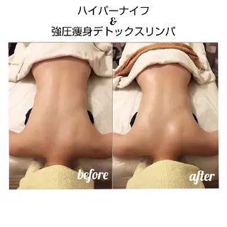 ニキビ•ニキビ跡改善 salon varyのエステ・リラクイメージ