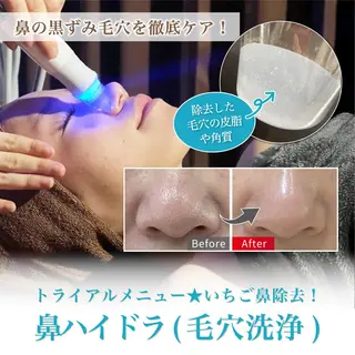 肌質改善専門 ハーブ /毛穴洗浄 リエイトのエステ・リラクイメージ