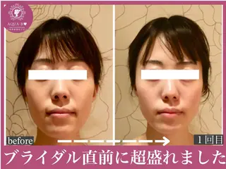 盛れる小顔矯正師 たく先生のエステ・リラクイメージ