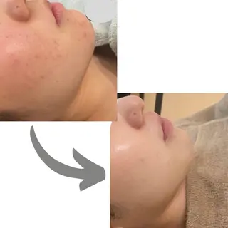 肌質改善サロン aimee｜アイミーのエステ・リラクイメージ