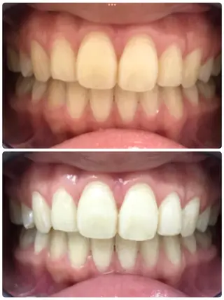 noel de mi 前川亜里沙のエステ・リラクイメージ