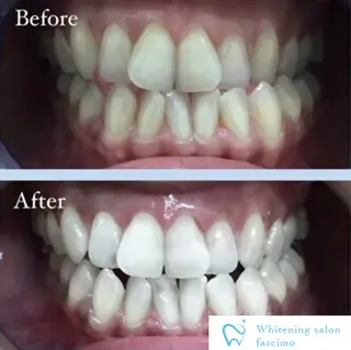 ホワイトニングサロン fascimo新座店のその他イメージ