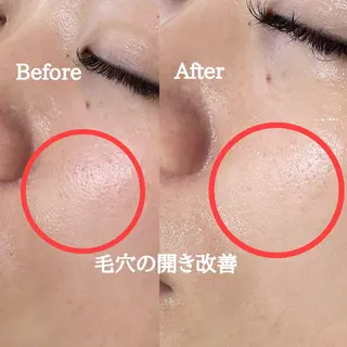 Surien 水脇ゆうのその他イメージ