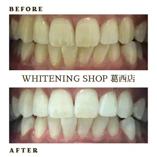 メンズ ホワイトニング ショップ葛西店のその他イメージ