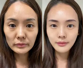 ネイル aliaハーブ水光店 エステティシャン募集のエステ・リラクイメージ