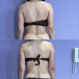 アプローズ所属・恵比寿/小顔/痩身 アプローズのエステ・リラクイメージ