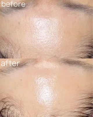 医療提携Beauty SalonMuseのエステ・リラクイメージ