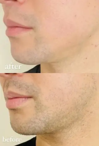 マツエク・マツパ MIU Rimの眉毛・アイブロウイメージ