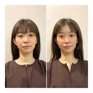 即小顔♥️美容鍼× ハーブピーリングのその他イメージ
