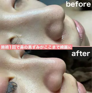 脱毛＆小顔コルギ 専門店 Lucirのエステ・リラクイメージ