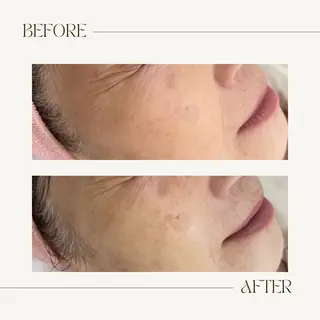 CEsalonEgg 齋藤のエステ・リラクイメージ