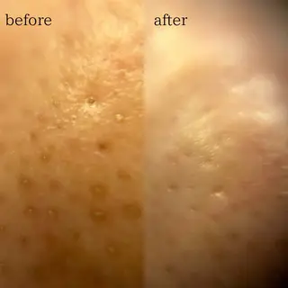 おかま直伝よもぎ蒸し 【aju】山本 亜樹のエステ・リラクイメージ