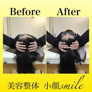 【小顔・姿勢矯正】 美容整体 SMILEのエステ・リラクイメージ