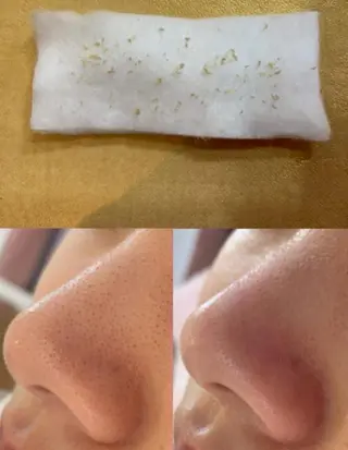 毛穴/毛穴洗浄専門 エミルカ船橋のエステ・リラクイメージ