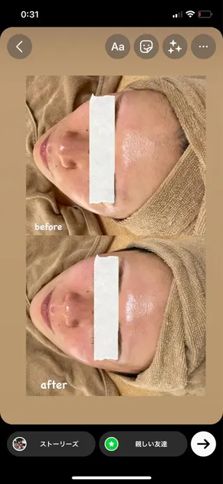 エステサロン Mi-mi.iのエステ・リラクイメージ