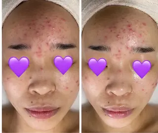 COCO beautyサロンのエステ・リラクイメージ