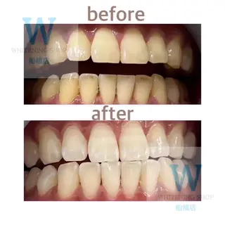 ホワイトニング ショップ船橋店🦷のエステ・リラクイメージ