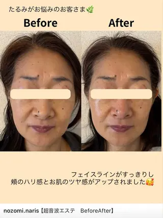 Novelle所属・nozomi.m🌷 narisのエステ・リラクイメージ