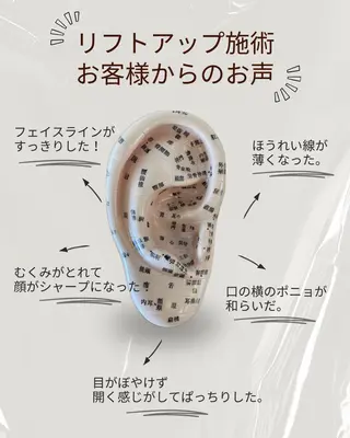 mimine エメラルド式耳つぼのその他イメージ