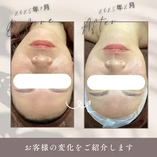 シミケア専科 Babyfaceのエステ・リラクイメージ