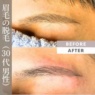 メンズ 【一本ずつ脱毛】 ReMove 柏のエステ・リラクイメージ