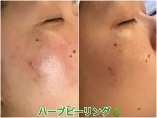 プライベートサロン VIALLのエステ・リラクイメージ