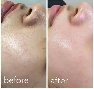 あだち整体エステ 首肩背中のゆるめぐのエステ・リラクイメージ