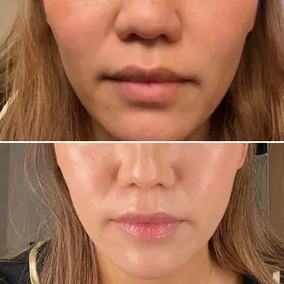 アイブロウ Epina 千葉店 【エピナ】のエステ・リラクイメージ