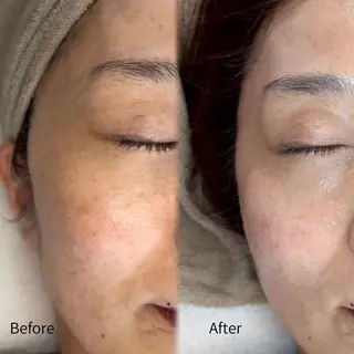 abbellina×uno所属・Anna / 出雲・肌質改善のエステ・リラクイメージ