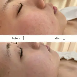 skinLabo所属・saya Mのエステ・リラクイメージ