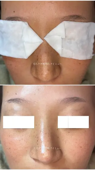 毛穴専門店アイミュー mamiのエステ・リラクイメージ