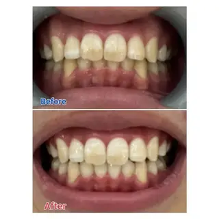 M渋谷 ホワイトニングのエステ・リラクイメージ