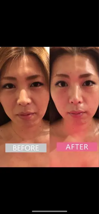 美容鍼灸サロン mahoroba院長のエステ・リラクイメージ