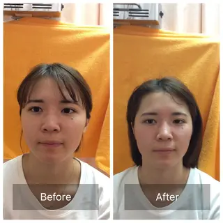 美容鍼×小顔矯正× 美容整体/小林幸司のエステ・リラクイメージ