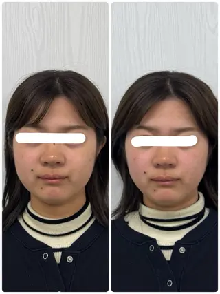 美容鍼×小顔矯正 ×美容整体　浜川泰仁のエステ・リラクイメージ