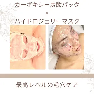 Lily luce 美骨小顔矯正のその他イメージ