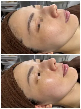 アンシャンテ トータルビューティーのエステ・リラクイメージ