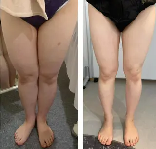 部分痩せ♥️小顔専門 MIKUのエステ・リラクイメージ