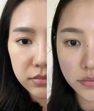 マツエク・マツパ aliaハーブ水光店 エステティシャン募集のエステ・リラクイメージ