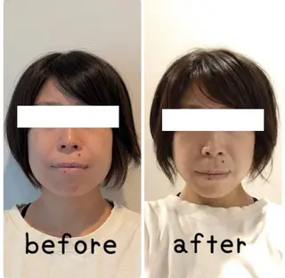 小顔と ヘッドスパのお店のエステ・リラクイメージ