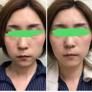 TELA HAIR 幕張本郷店 千尋のヘアスタイル