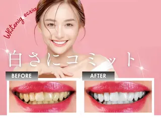 セルフホワイトニング エクシア秋田大町店のその他イメージ